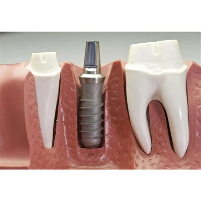 Inductive Bone Regeneration Capability